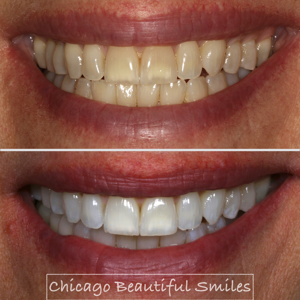 The Role of Digital Photography in Dentistry Chicago Beautiful Smiles
