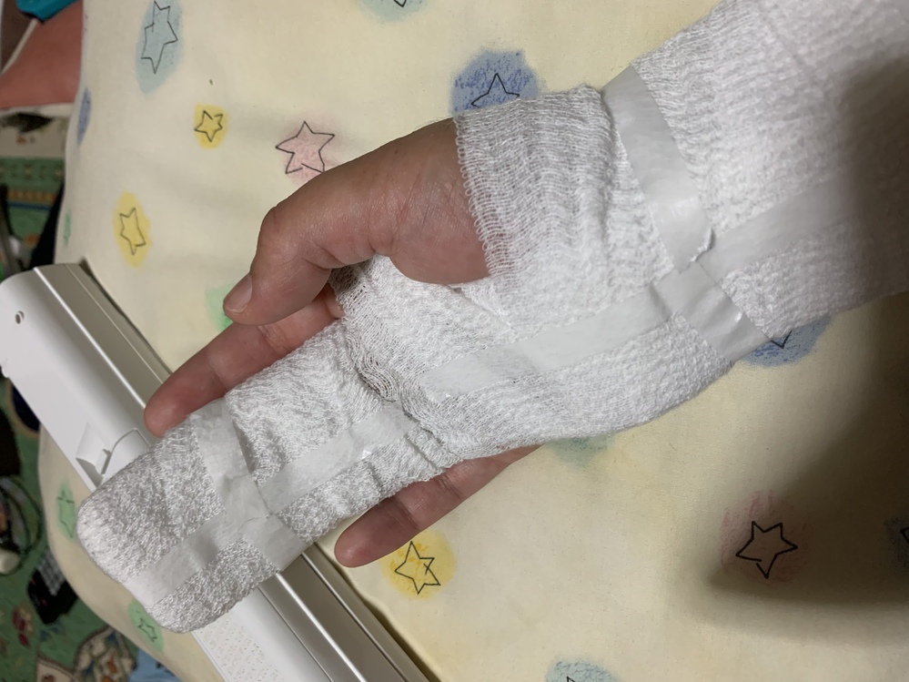 シーネ固定って何ですが？包帯とかギプスとどう違うんですか？ 熱可塑... Yahoo!知恵袋