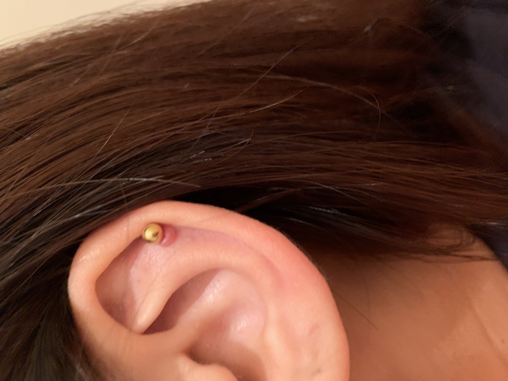 ドルマイシン軟膏は長い間、使い続けて大丈夫でしょうか?ステロイド軟... Yahoo!知恵袋