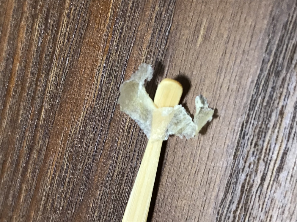 でかすぎる耳くそ こんなでかいのが出てきました。耳掻きでもなく、綿棒... Yahoo!知恵袋