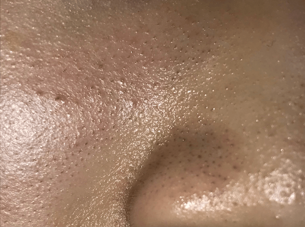 皮膚科でサラダ油は一番良い洗剤だと言われました。皮膚の乾燥による肌荒れで受診し... Yahoo!知恵袋