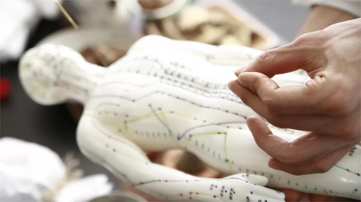 Yellow Emperor Acupuncture Merging Ancient Wisdom with Modern Healing