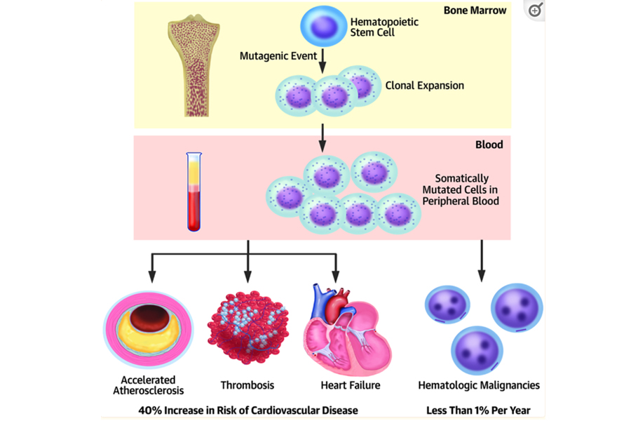 Clonal Hematopoiesis Crossroads of Aging, Cardiovascular Disease, and