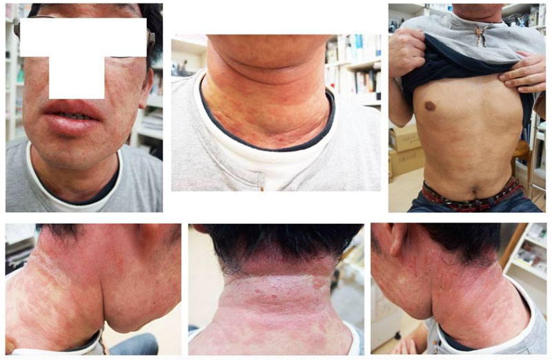 治療家のための電磁波セミナーDVD～正しい知識が身体の不調を改善させる～