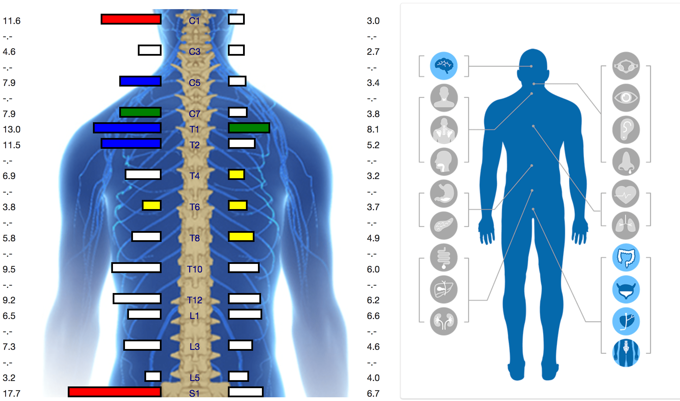 Neurological Testing Using Insight neuroTech True Chiropractic Wellness