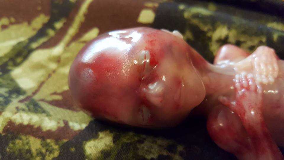 Mother Shares Photos of 'Perfectly, Wonderfully Formed' Son Miscarried