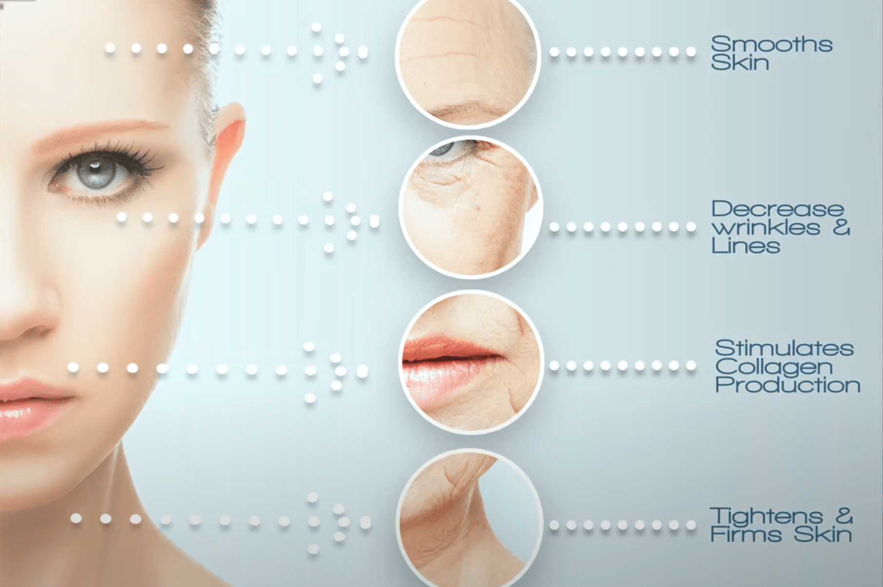 Liquid Nitrogen Treatment Christie Care