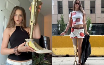 Το χρυσό τεχνητό μέλος του TikTok