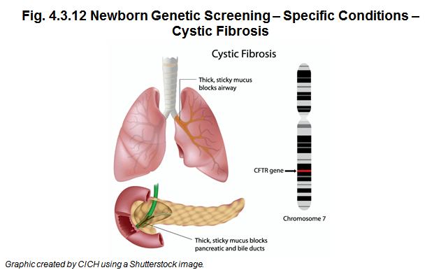 Newborn Screening Specific Conditions Cystic Fibrosis The