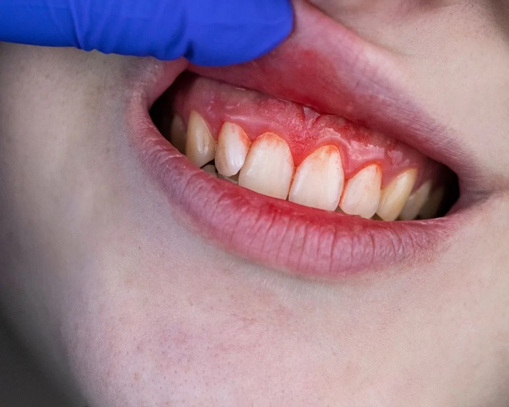 Can Tooth Pain Cause Chest Pain Explore At Cidentist