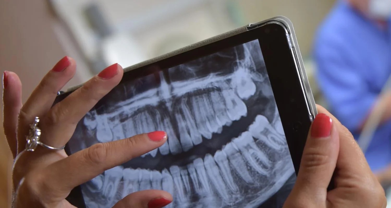 Dental XRays Vs Panoramic XRays (3 Safety And Precautions)