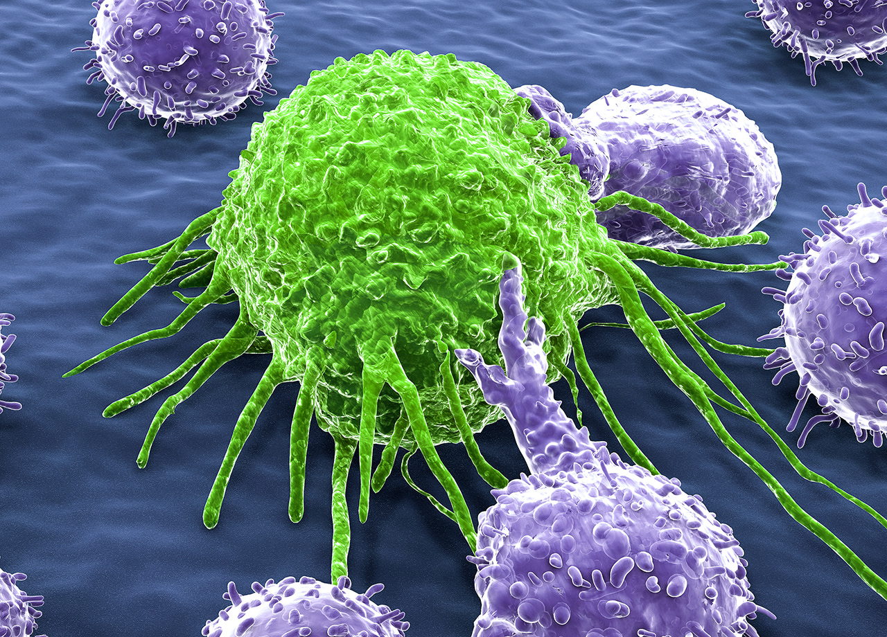 Haploidentical NK cell therapy Cimaas