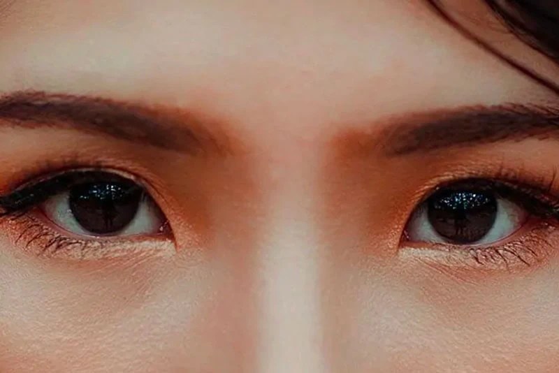 Dry Eyes After LASIK? Is This Normal? Ciputra SMG Eye Clinic