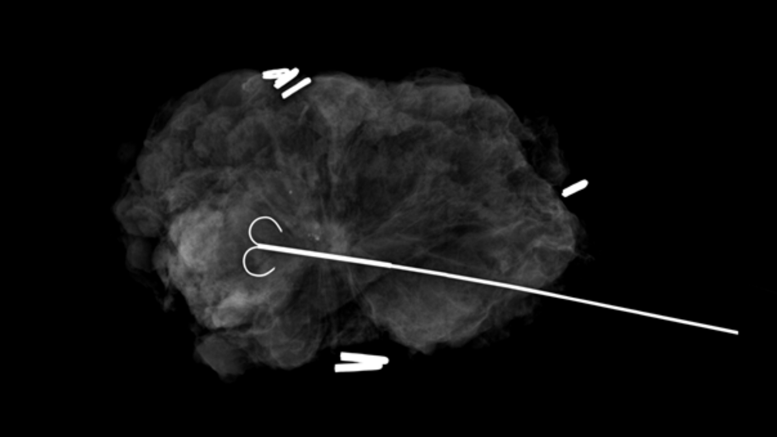Specimen Radiography System Solas OR Cirdan