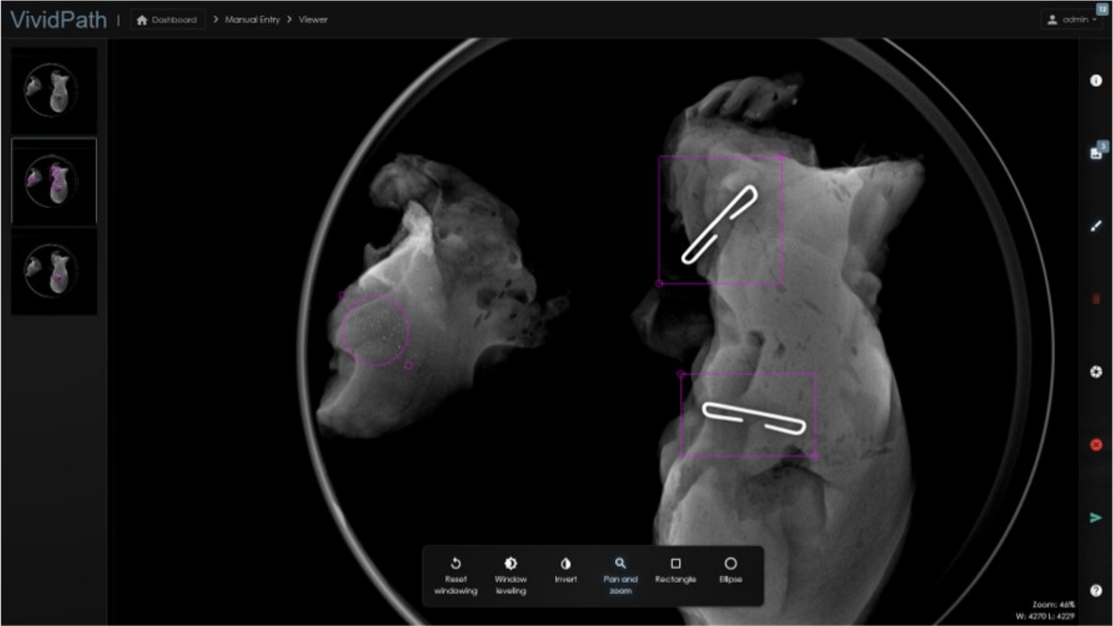 Introducing Solas OR Specimen Radiography System Cirdan