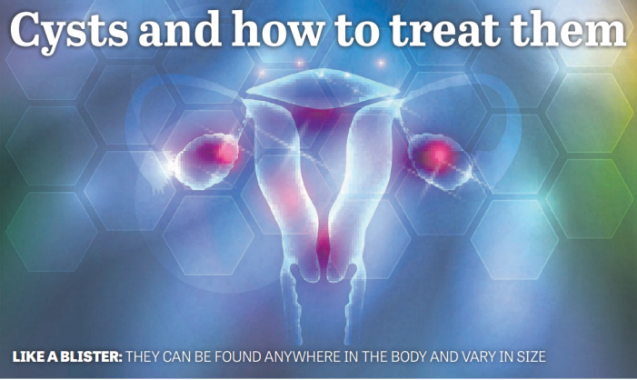 Positive Pregnancy Test But Not Pregnant Ovarian Cyst pregnancy test