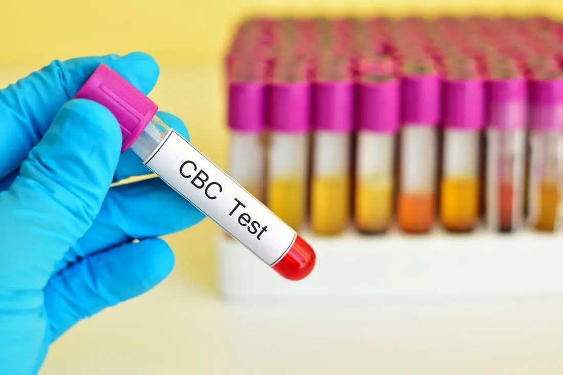 MCHC Blood Test