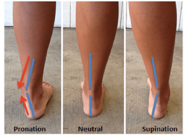 Pronation in Running & Walking Foot Function in Runners Foot