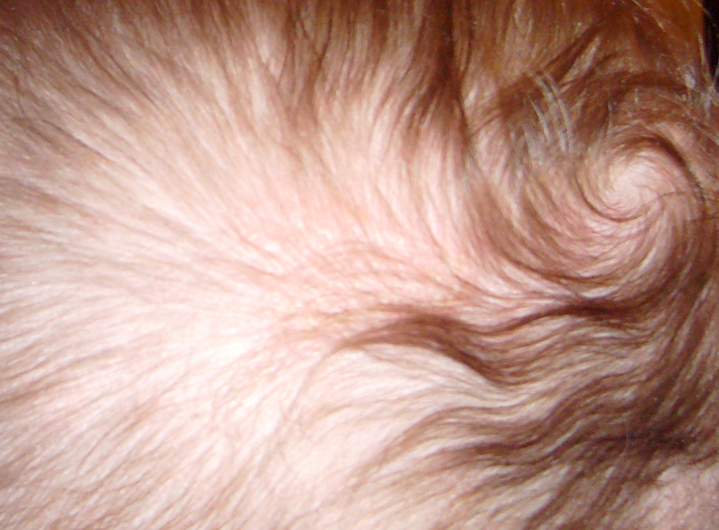 Bebe 4 mois plaques sur le cuir chevelu Soins quotidiens de bébé