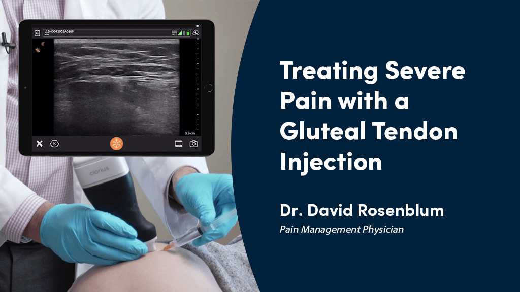[VIDEO] Pain Management Case Study Treating Severe Pain with a Gluteal