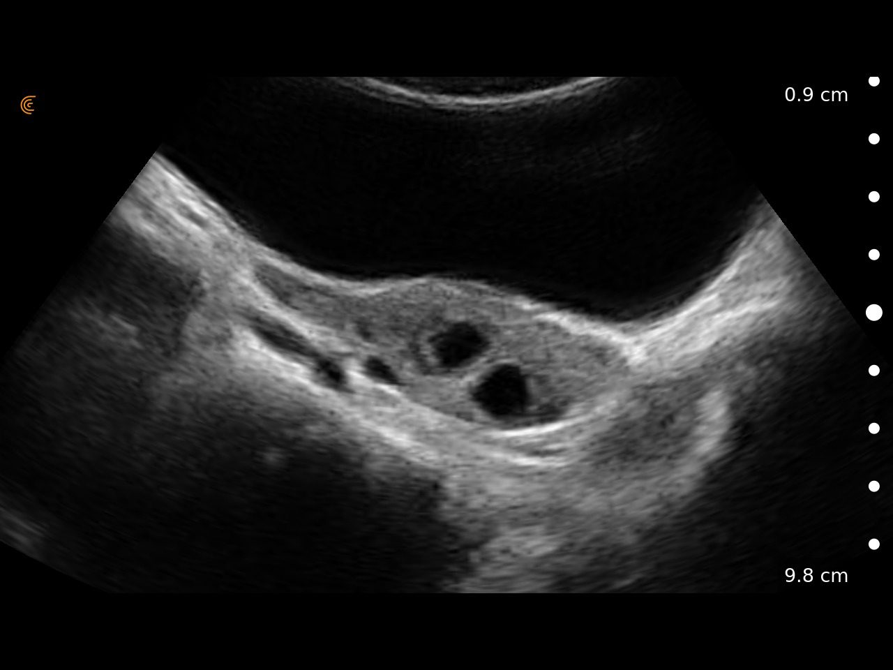 Convex Scanner Clarius