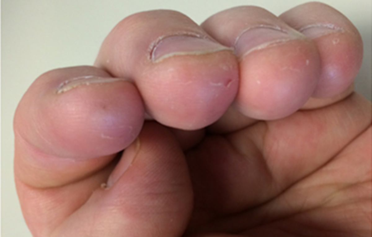 The Guitarist’s Guide to Calluses Formation, Care, and Maintenance