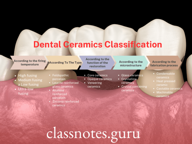 Dental Ceramics Classification, Composition, Properties Class Notes