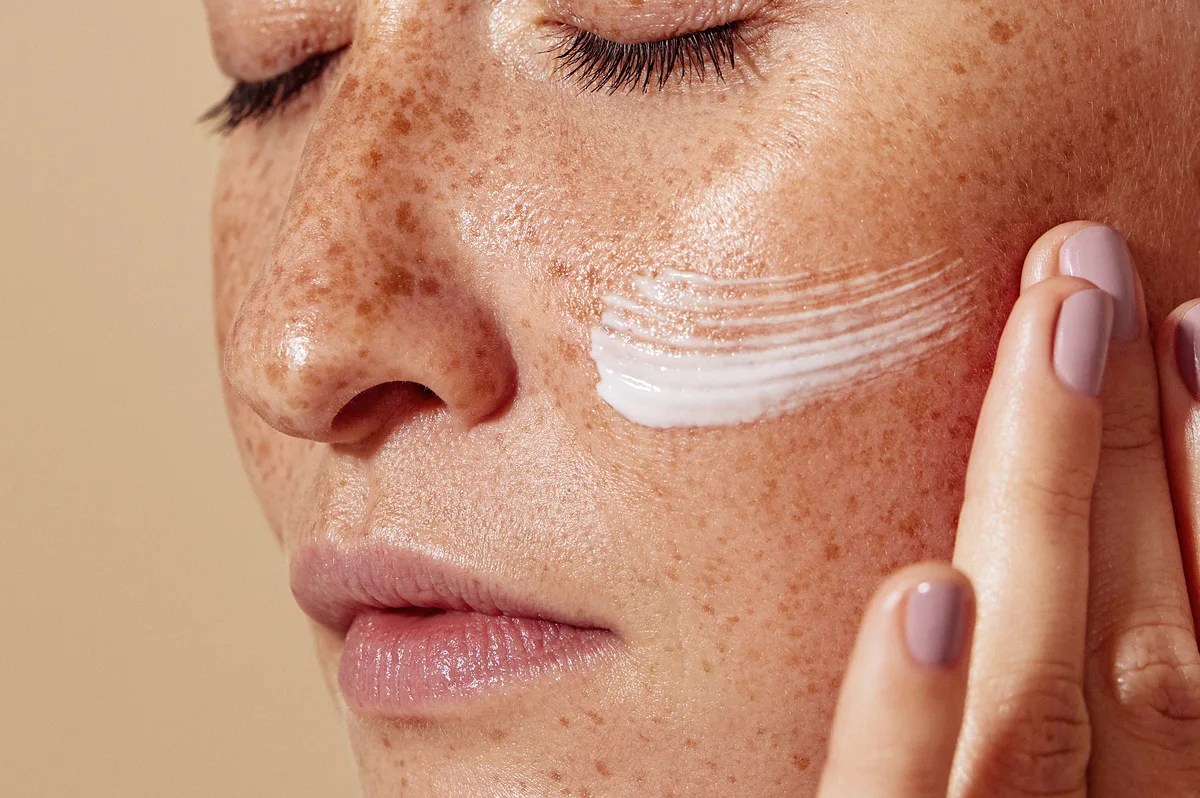 Do Freckles Bother You? Find Out How to Remove Them Here!