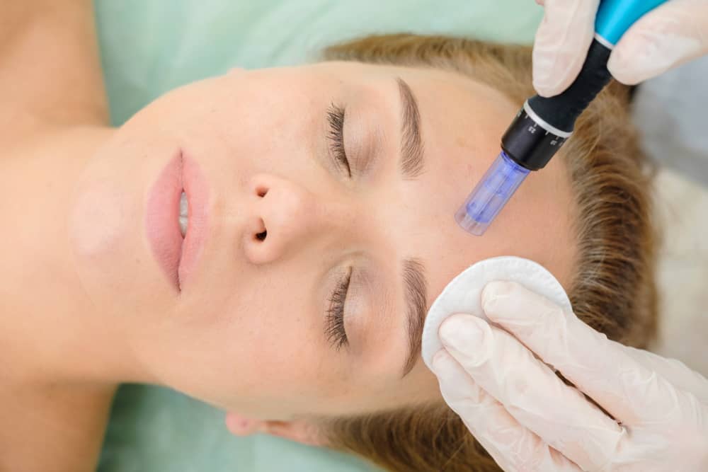 Microneedling Clear Lake Dermatology
