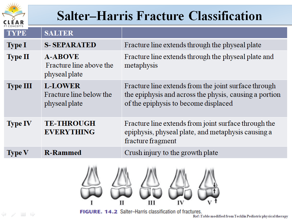 SalterHarris Fracture Classification clearptconcepts