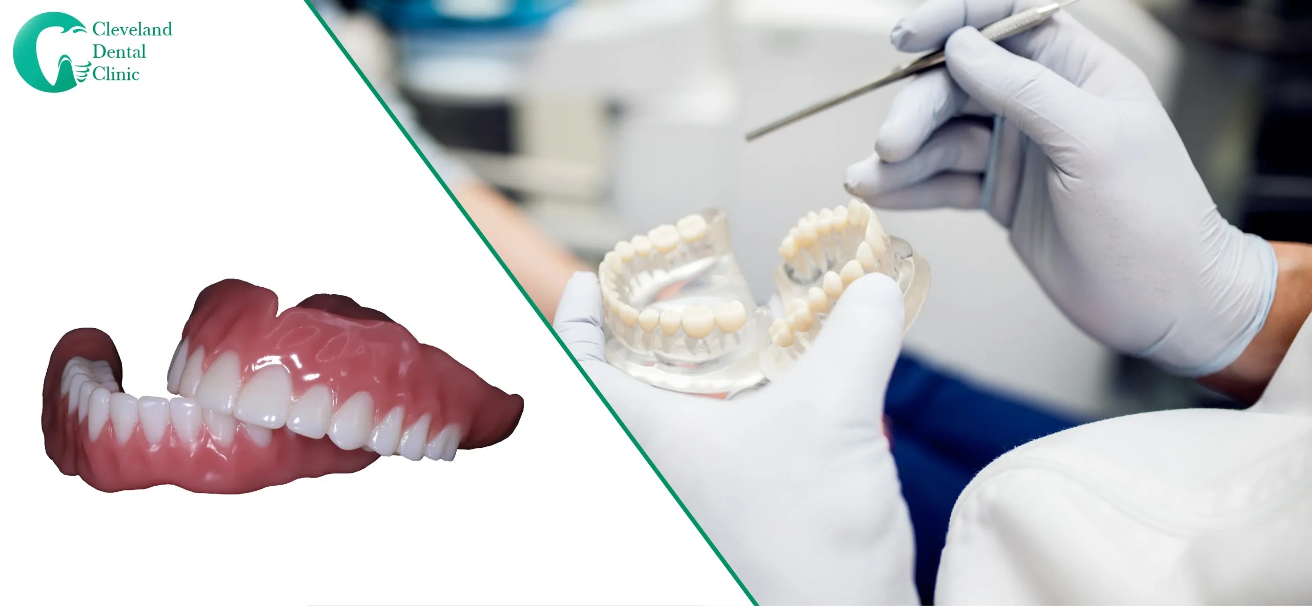 Same day Dentures Vs Traditional Dentures Which is better?