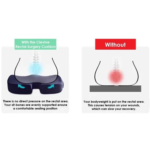 Clevive™ Rectal Surgery Cushion Clevive