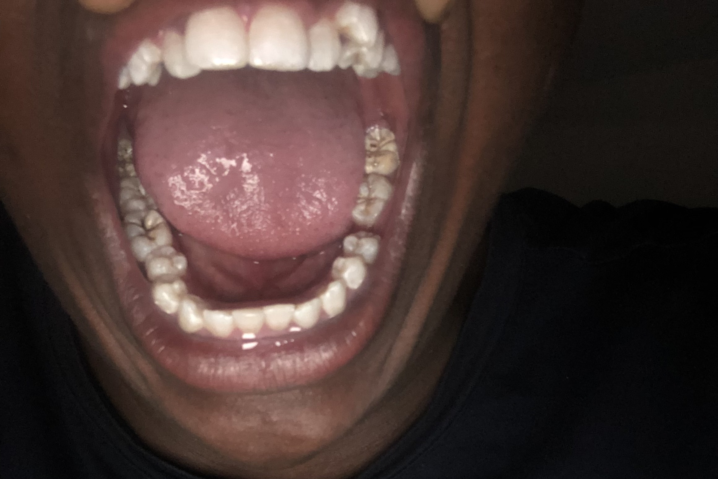 ORTHODONTIC BILLS R34 000 Click 'n Donate, Fundraising South Africa