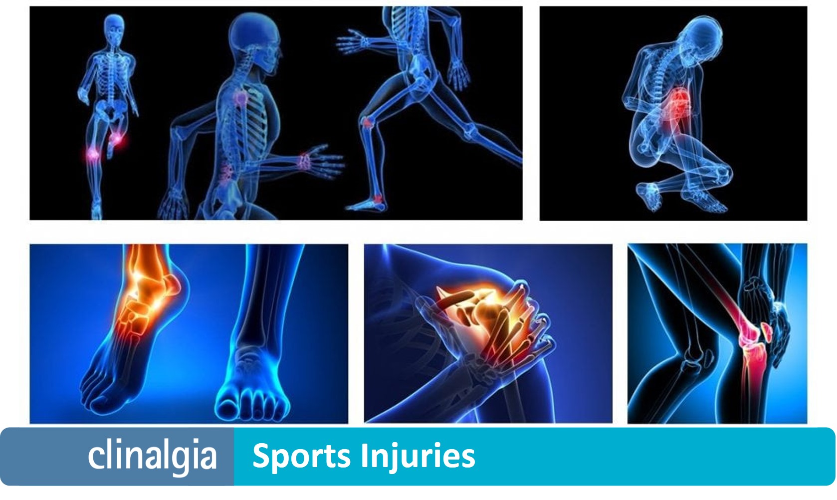 Sports Injuries what they are, causes and type Clinalgia Sports Clinic