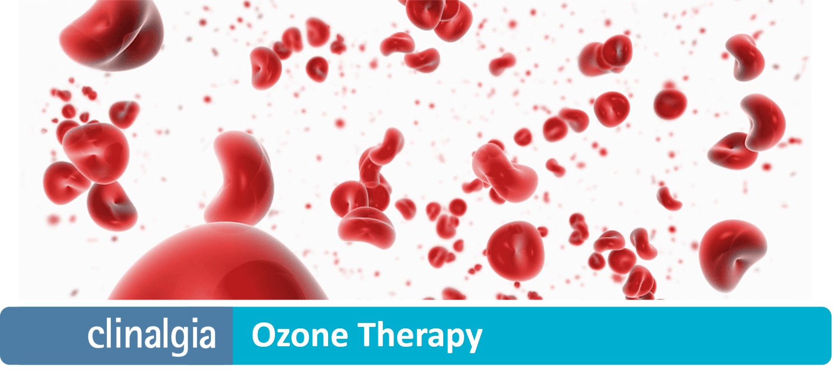 Ozone Therapy What it is, What it's for, Benefits and much more