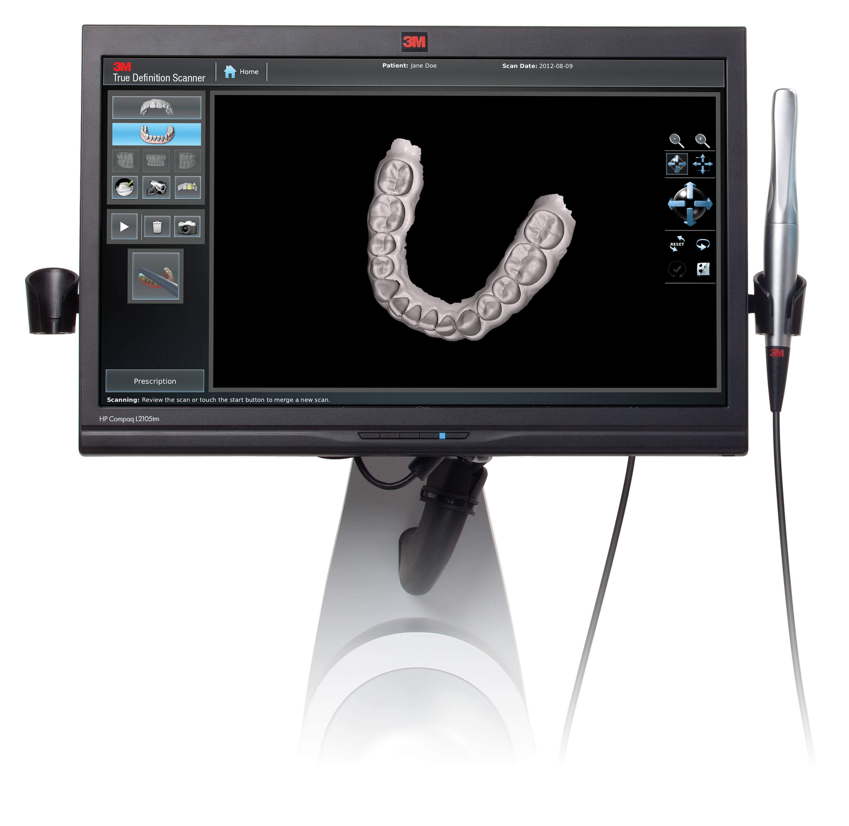 Escaner Intraoral 3D Clinica Dental Benifaio Clínica Beltrán