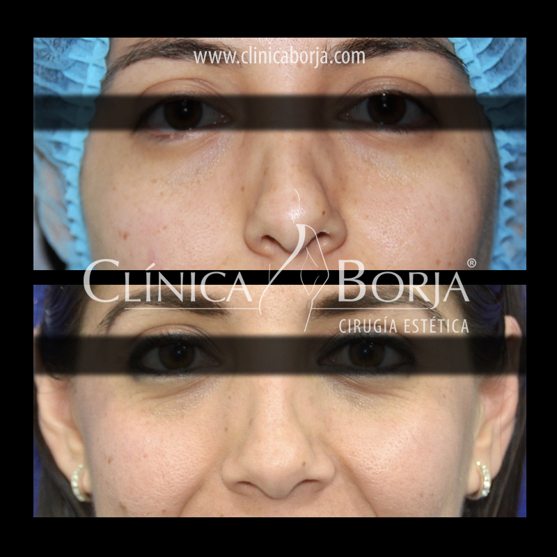 Clínica Borja Cirugía Estética