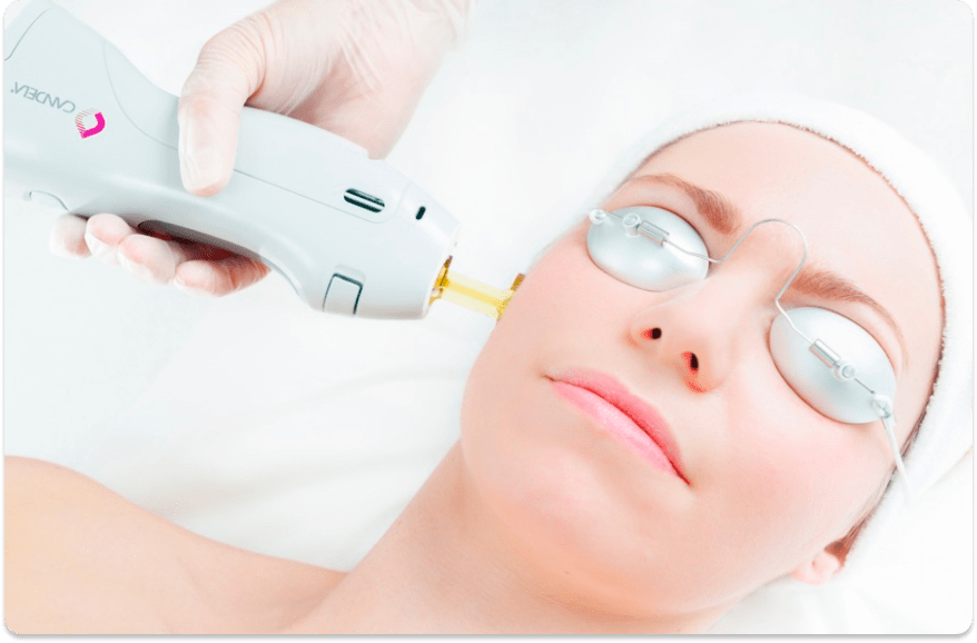 Láser Nd Yag 1064 Clínica medico estética Dr. Abbas