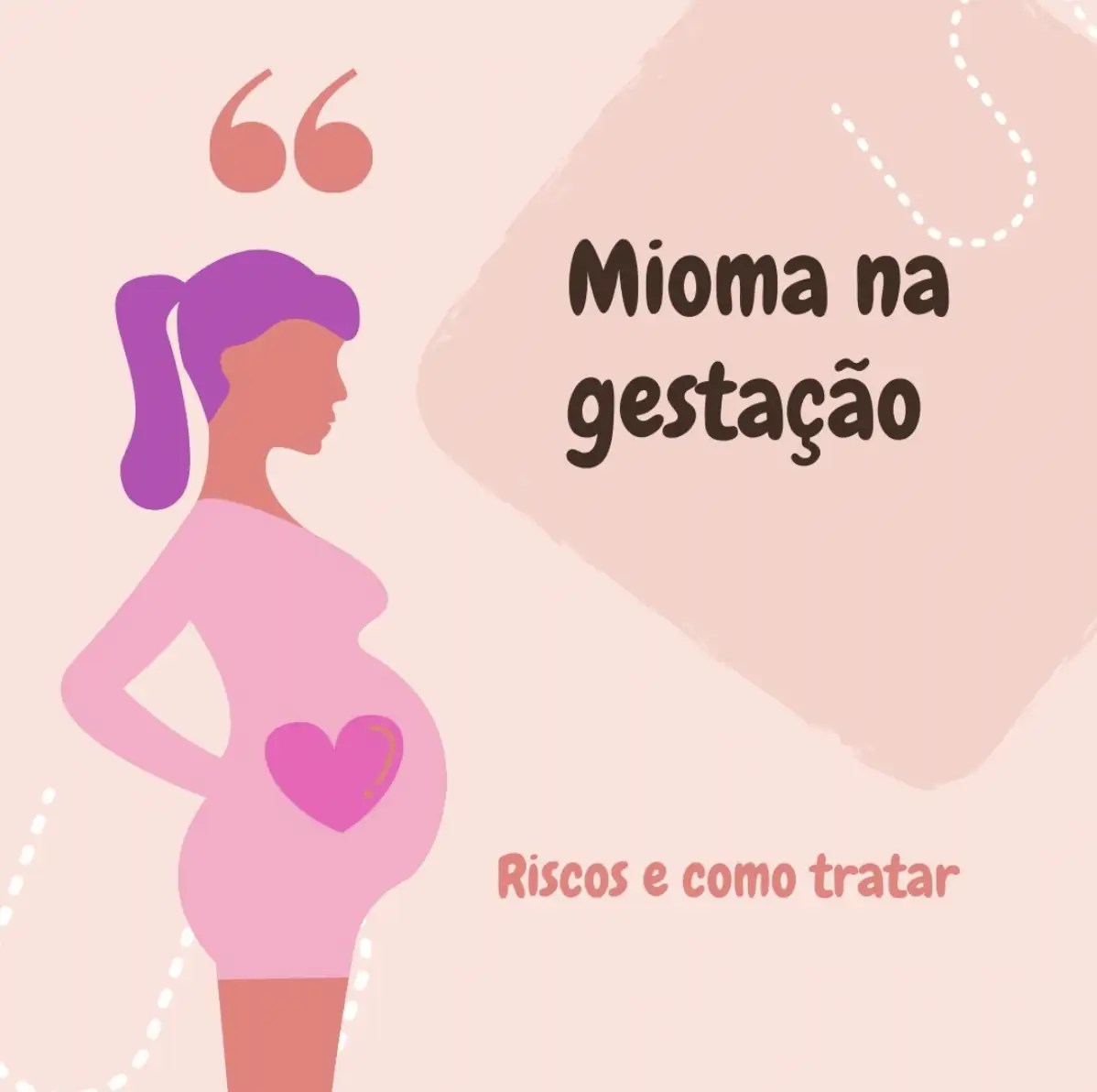 Endometriose FGO Clínica de Fertilização