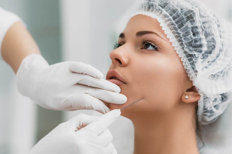 Hilos tensores faciales Clínica ITYOS