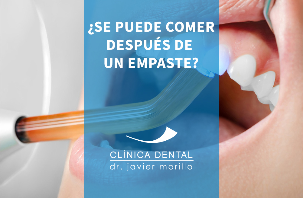 ¿SE PUEDE COMER DESPUÉS DE UN EMPASTE? Clínica Javier Morillo
