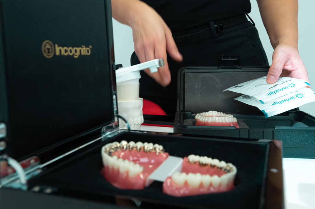 ¿Podré hablar con los brackets detrás de los dientes? Blog Clínica Kaizen