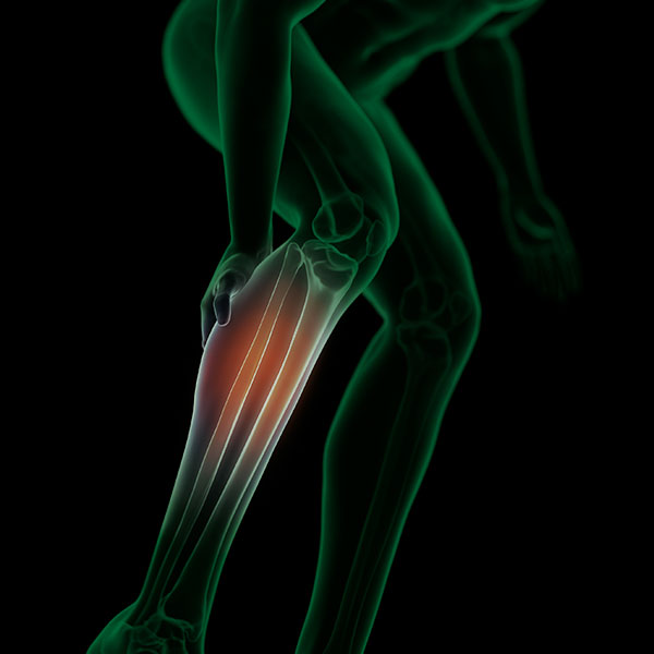 Periostitis Tratamiento Clínica Sohail