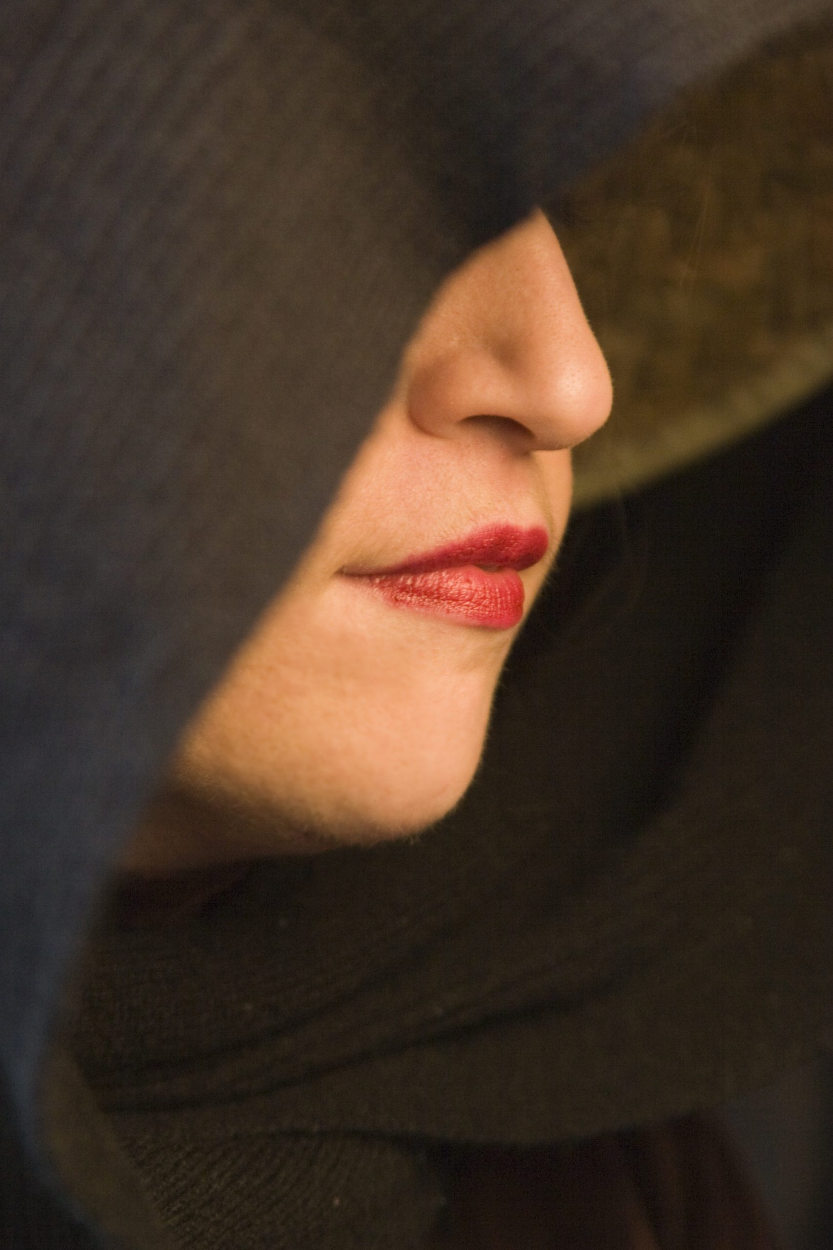 Rhinoplasty before and after, rhinoplasty UK, cost, recovery, procedure