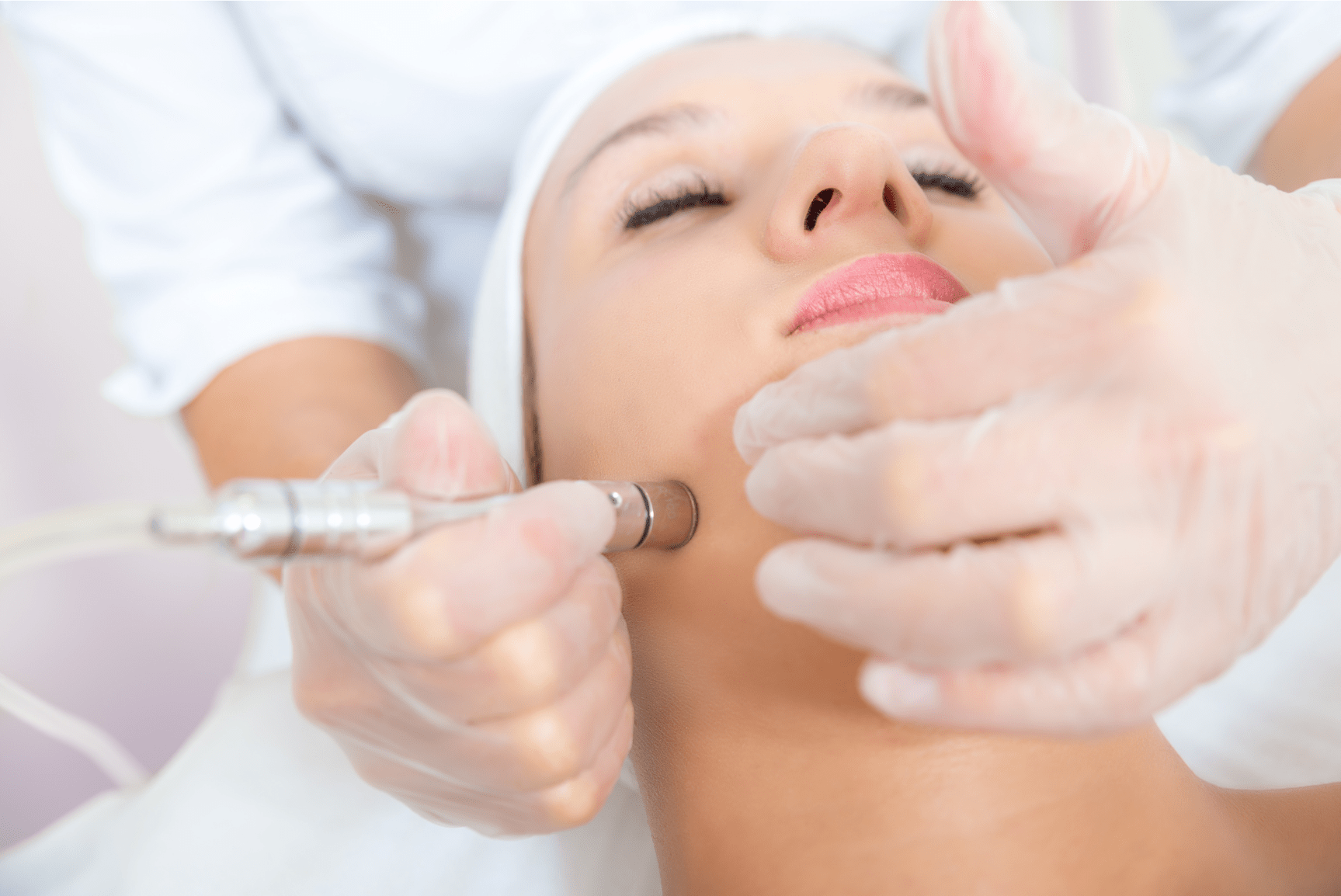 Cost Of Microdermabrasion In Bangalore Offer INR 3500