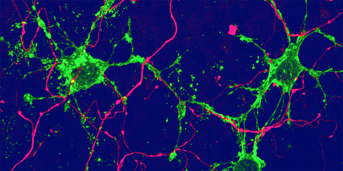 New glial cells discovered in the brain Implications for brain repair