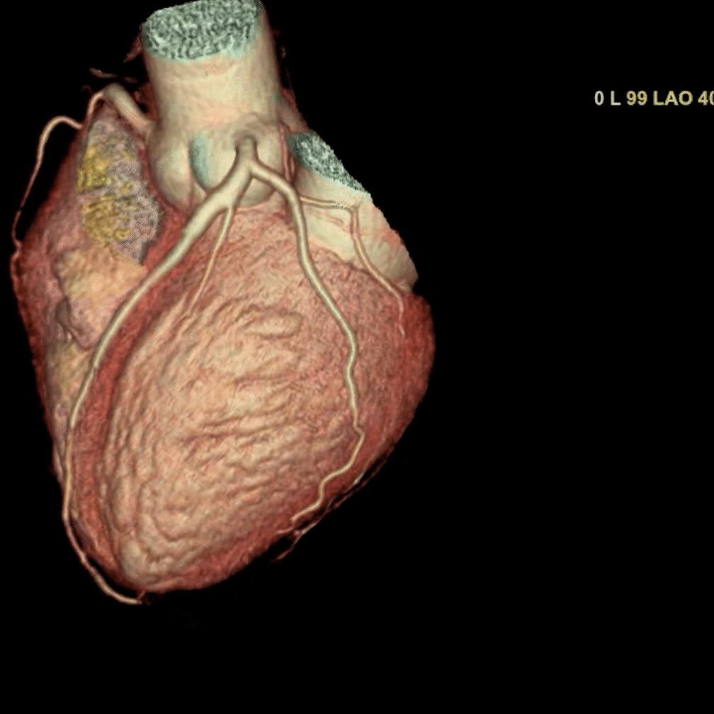 CT Angio clinnextcro