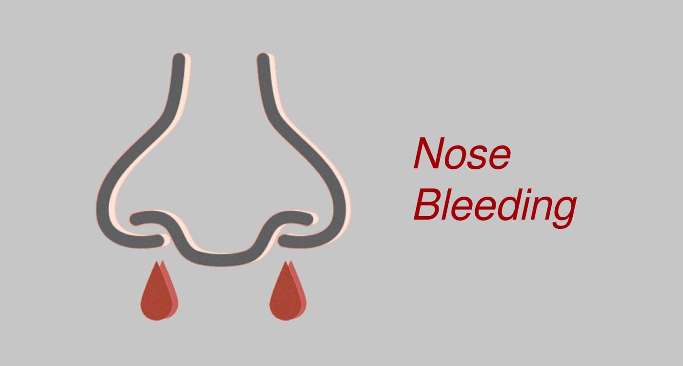 Free Vectors Boy with nosebleed Clip Art Library