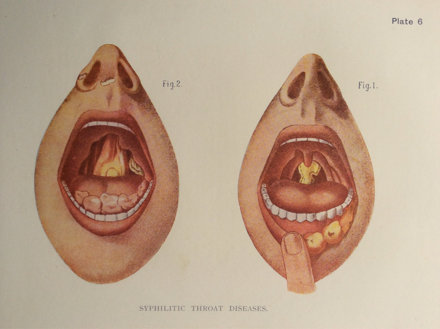 Popular items for mouth teeth