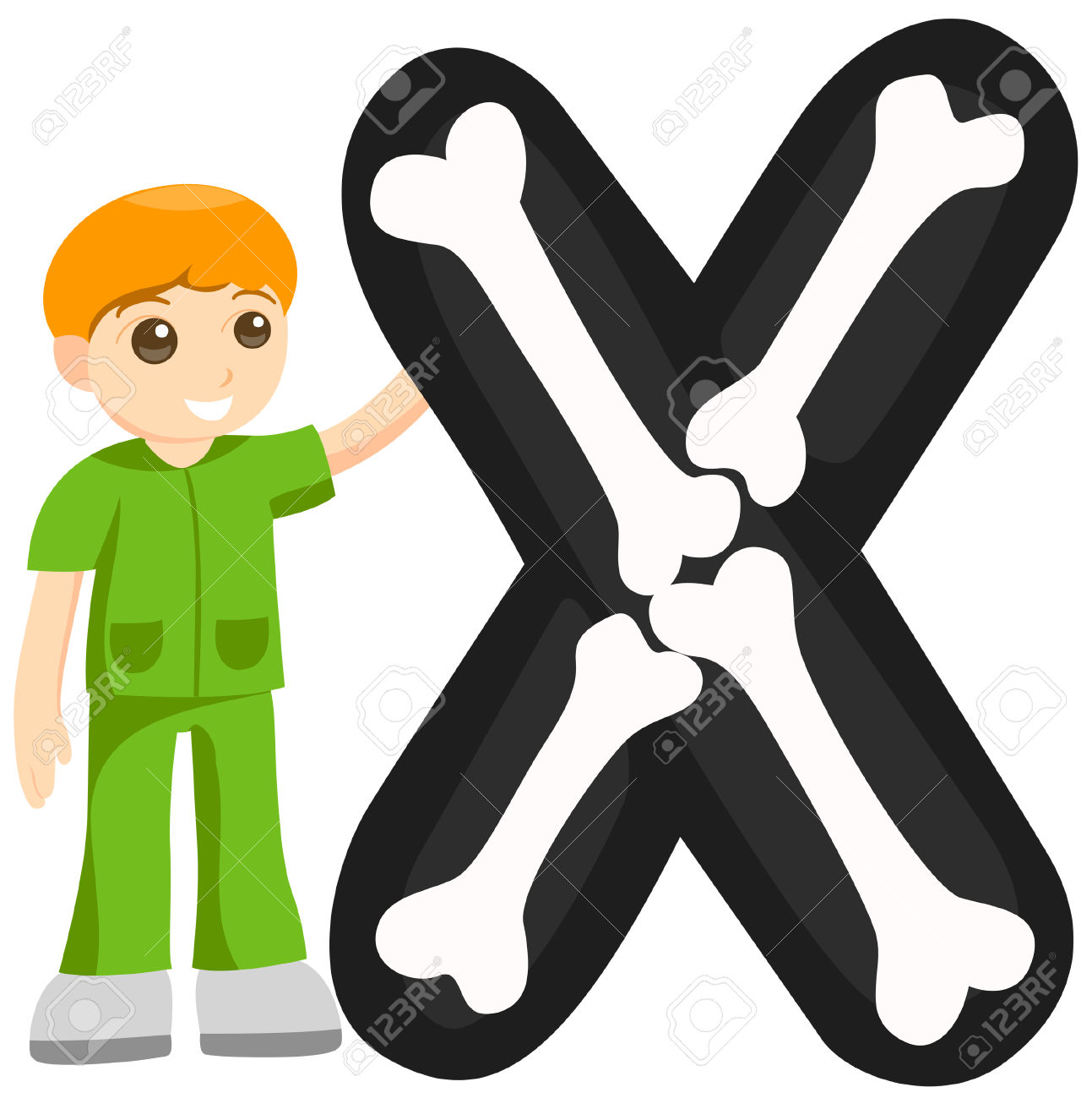 Hand Xray Cliparts Visual Aids for Medical Professionals